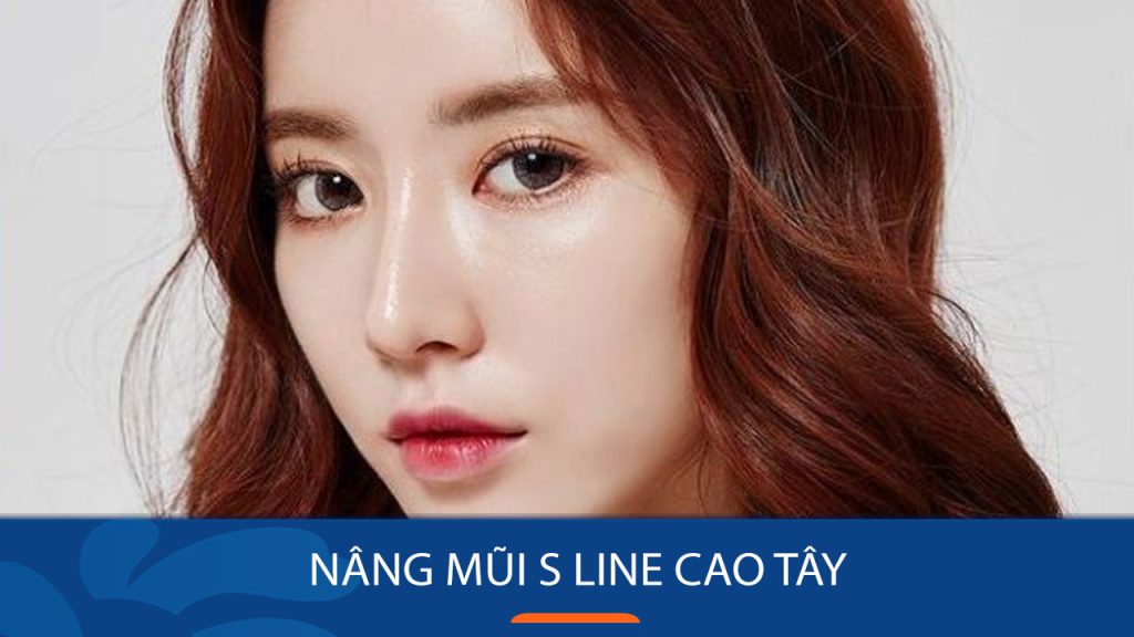 Nâng mũi S line cao tây: Bí quyết sở hữu dáng mũi đẹp hoàn hảo