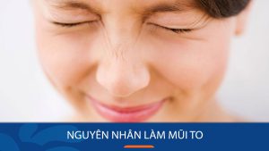 Nguyên nhân làm mũi to – Cách khắc phục mũi to hiệu quả