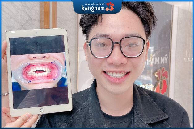Niềng chỉnh răng hiệu quả vượt trội tại BV Kangnam