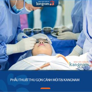 3 Điều cần biết về phẫu thuật thu gọn cánh mũi tại BV kangnam