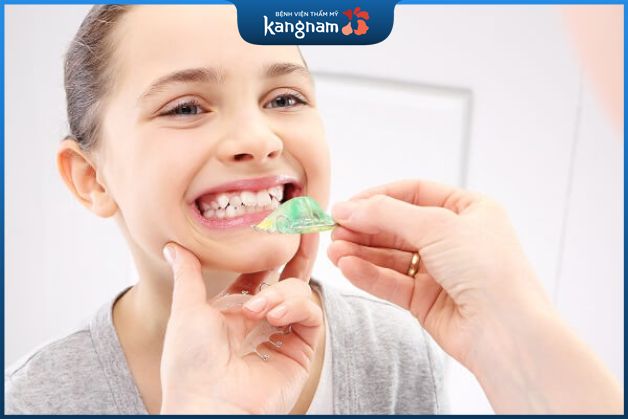 Vì sao nên cho trẻ em niềng răng tháo lắp sớm?