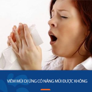 Bị viêm mũi dị ứng có nâng mũi được không – BV kangnam