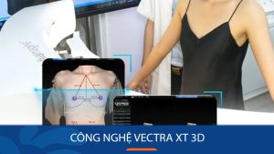 Công nghệ Hình Ảnh Vectra XT 3D: Xem trước kết quả thẩm mỹ