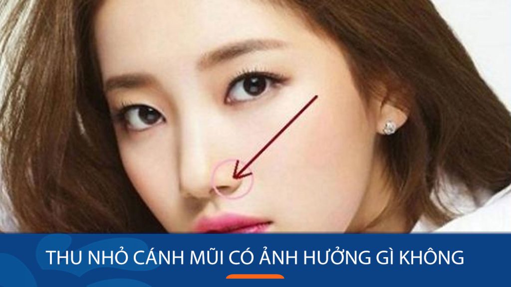 Thu nhỏ cánh mũi có ảnh hưởng gì không? 3 Khía cạnh cần xem xét