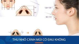 Thu nhỏ cánh mũi có đau không? 3 yếu tố tiên quyết không thể bỏ qua