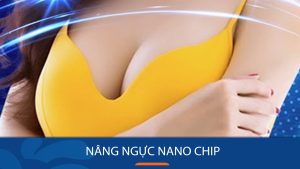 Nâng ngực Nano Chip – Không phẫu thuật, không xâm lấn, không cần nghỉ dưỡng