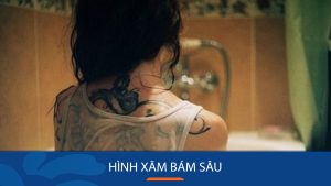 Cách xóa hình xăm bám sâu và lâu ngày hiệu quả nhất?