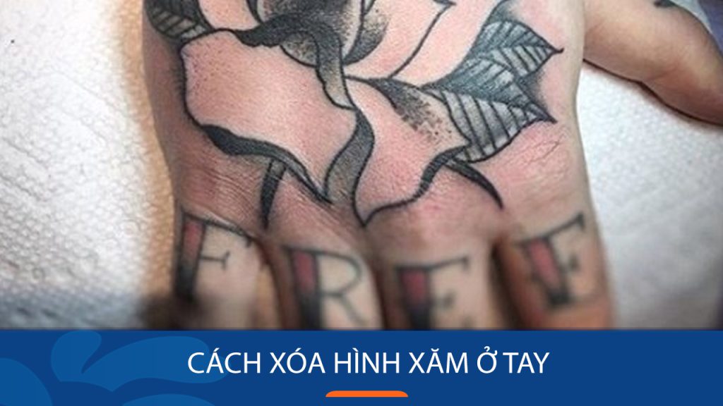 Cách xóa hình xăm ở tay hiệu quả và an toàn