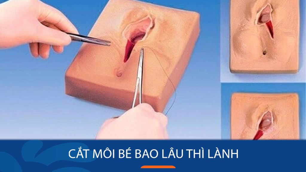 Cắt môi bé bao lâu thì lành? Hướng dẫn chi tiết về quá trình và cách đẩy nhanh hồi phục