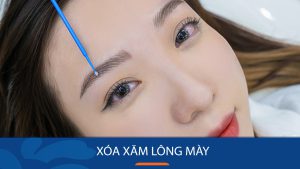 kinh nghiệm xóa xăm lông mày xương máu của chị em