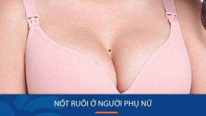 14 Vị Trí Nốt Ruồi “Phú Quý Hơn Vàng” Mang Lại May Mắn Cho Phụ Nữ