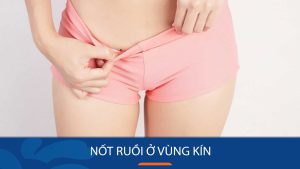 Nốt Ruồi Ở Vùng Kín: Giải Mã Bí Ẩn Nhân Tướng Học Nam Nữ