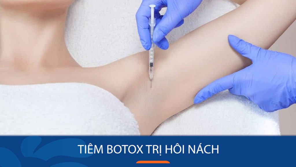 Tiêm Botox trị hôi nách – Loại trừ hơn 90% mùi hôi khó chịu