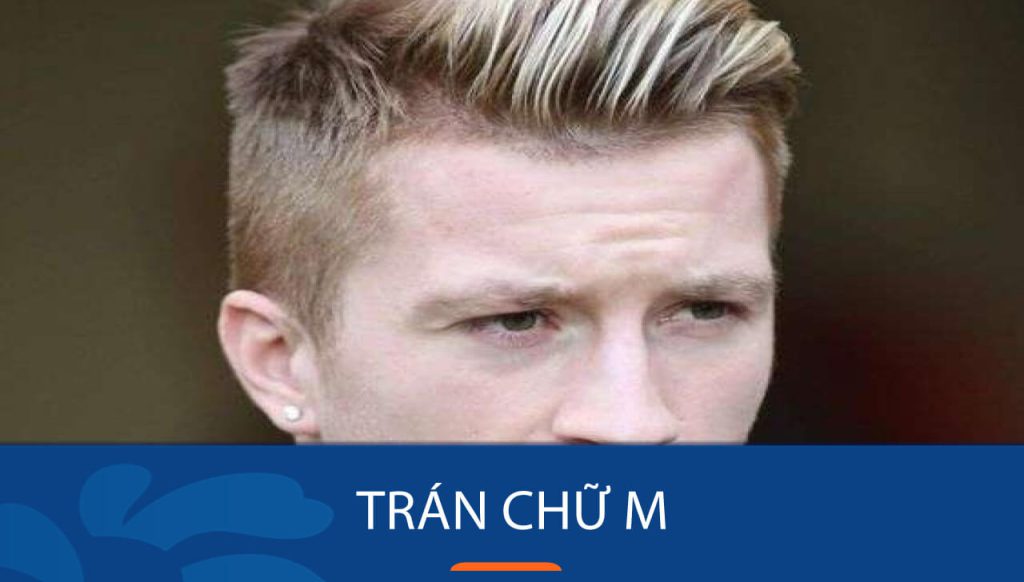 Trán chữ M: ý nghĩa tướng số, kiểu tóc hợp và cách đổi tướng phú quý