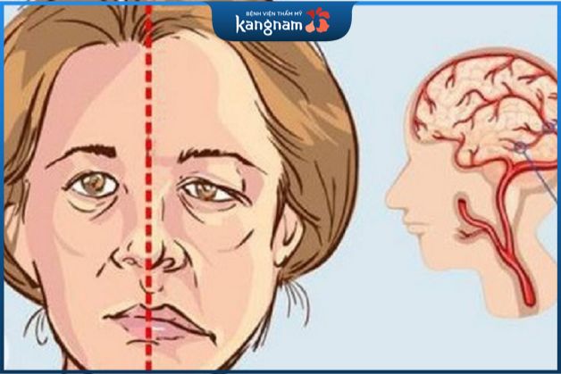 Tuổi già khiến mặt bị lệch