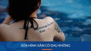 Xóa hình xăm có đau không, có an toàn và để lại sẹo không?