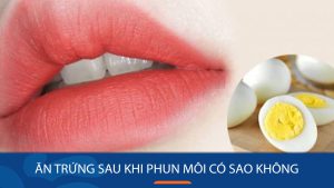 Ăn trứng sau khi phun môi có sao không? Kangnam giải đáp