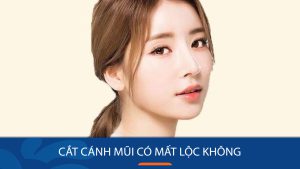 Cắt cánh mũi có mất lộc không? Góc nhìn chuyên gia