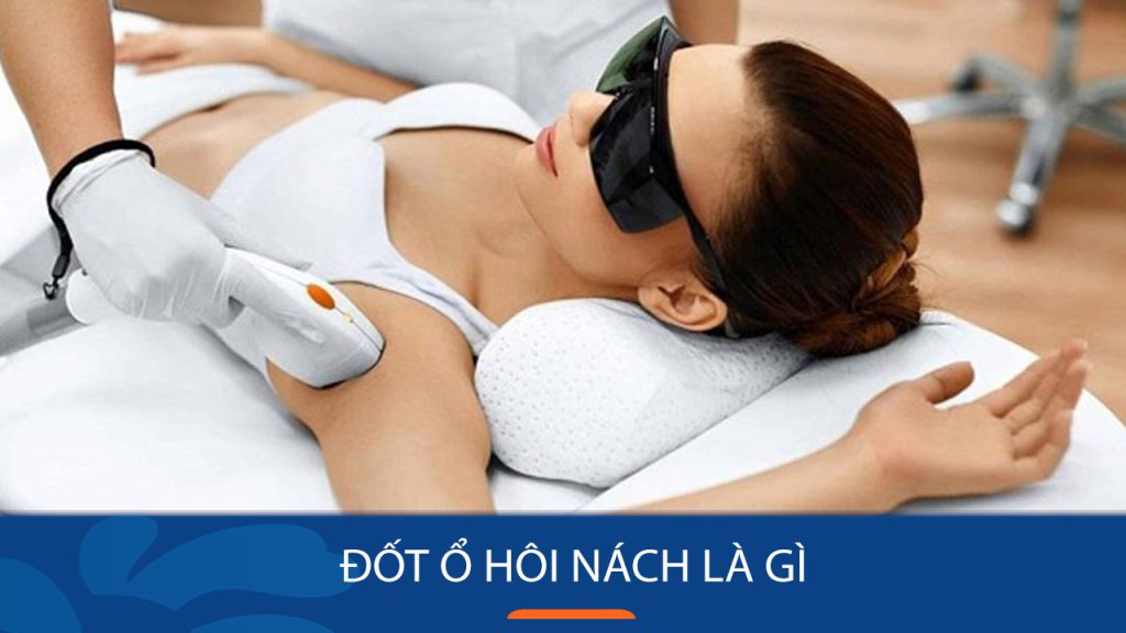 Đốt ổ hôi nách là gì? Có hiệu quả không? Giá bao nhiêu?