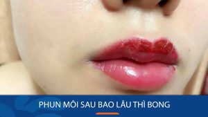 Phun môi bao lâu thì bong vảy? Hướng dẫn chăm sóc môi sau phun