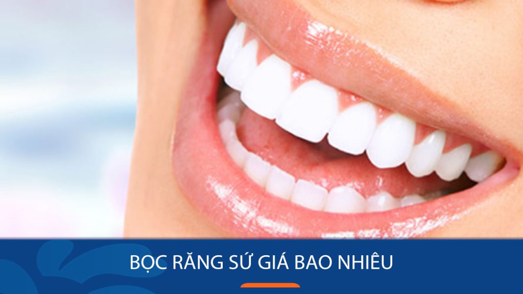 Bọc răng sứ giá bao nhiêu tiền 1 chiếc? Các yếu tố ảnh hưởng tới chi phí