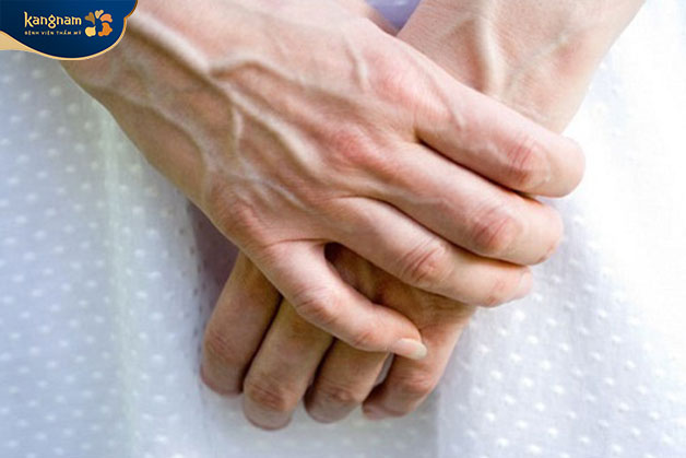 Da tay bị nhăn do lão hóa, cơ thể mất nước thậm chí là dấu hiệu của 1 bệnh lý đang phát triển trong cơ thể.