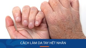 12 Cách làm da tay hết Nhăn Nheo hoàn toàn, hết nhăn chỉ sau 1 tháng?