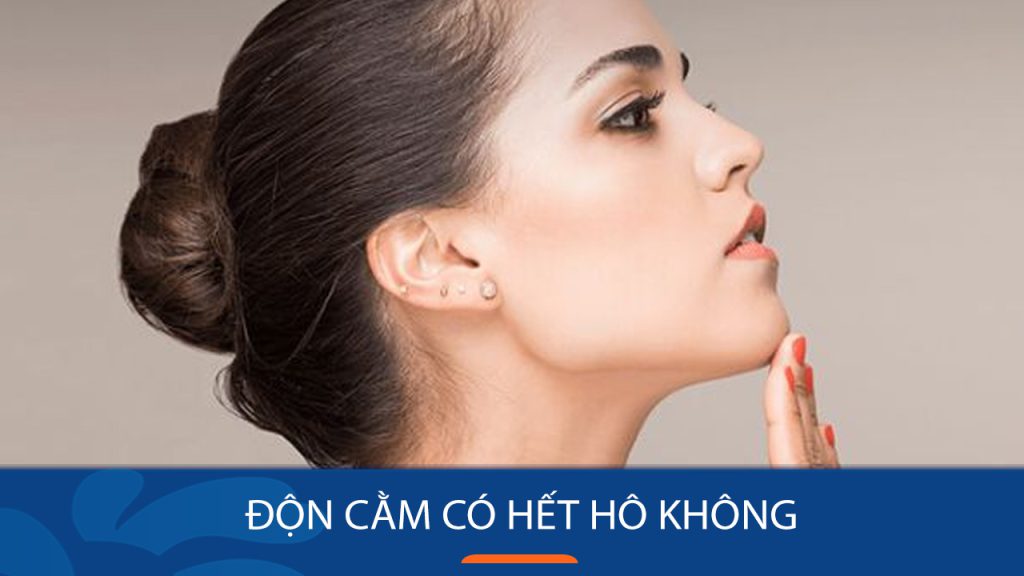 Độn cằm có hết hô không? – Giải đáp thắc mắc từ chuyên gia