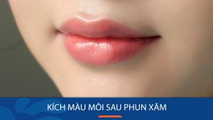 Kích màu môi sau phun xăm: Nên hay không nên?