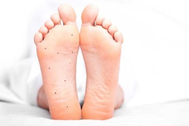 nốt ruồi dưới lòng bàn chân là cực kỳ hiếm, đại diện cho người có số mệnh cực tốt