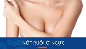 Giải mã nốt ruồi ở ngực: Bí ẩn vận mệnh nam nữ