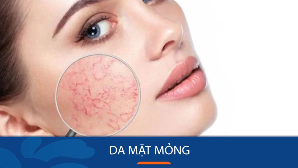 Da mặt mỏng: Dấu hiệu, nguyên nhân, cách khắc phục hiệu quả