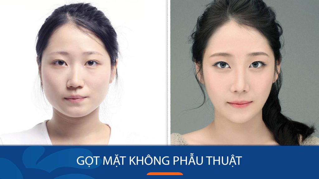 Cách Gọt Mặt Không Phẫu Thuật An Toàn & Hiệu Quả