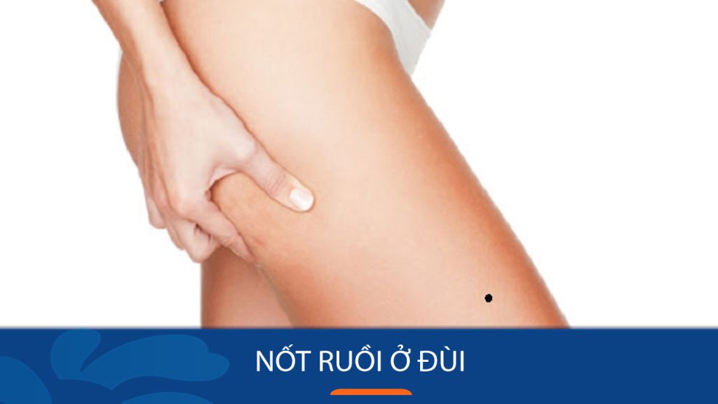 Nốt ruồi ở Đùi: Giải mã bí ẩn vận mệnh tương lai, tài lộc Nam, Nữ