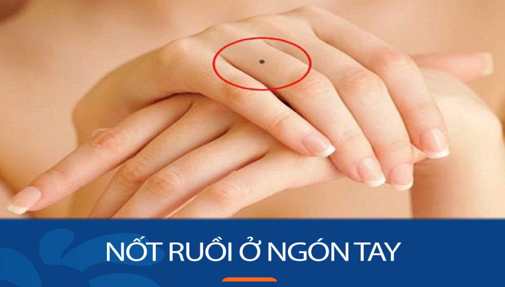 Nốt ruồi ở ngón tay nói gì về BẠN? Giải mã bí ẩn số mệnh ngay!