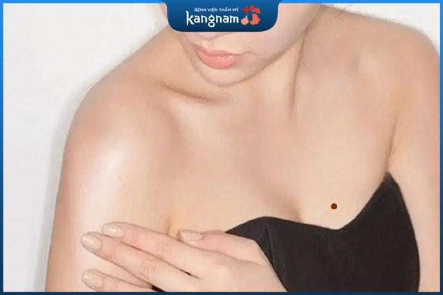 Nốt ruồi ở bầu ngực được xem là mang đến phú quý cho người sở hữu 