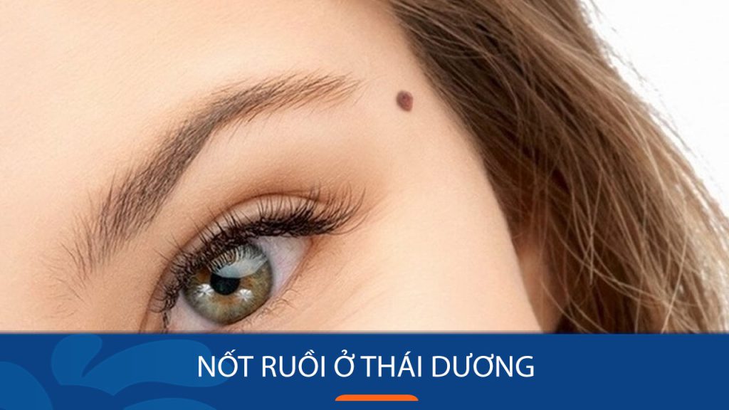 Nốt Ruồi Thái Dương: Giải Mã Bí Ẩn Định Mệnh, Tính Cách Nam Nữ