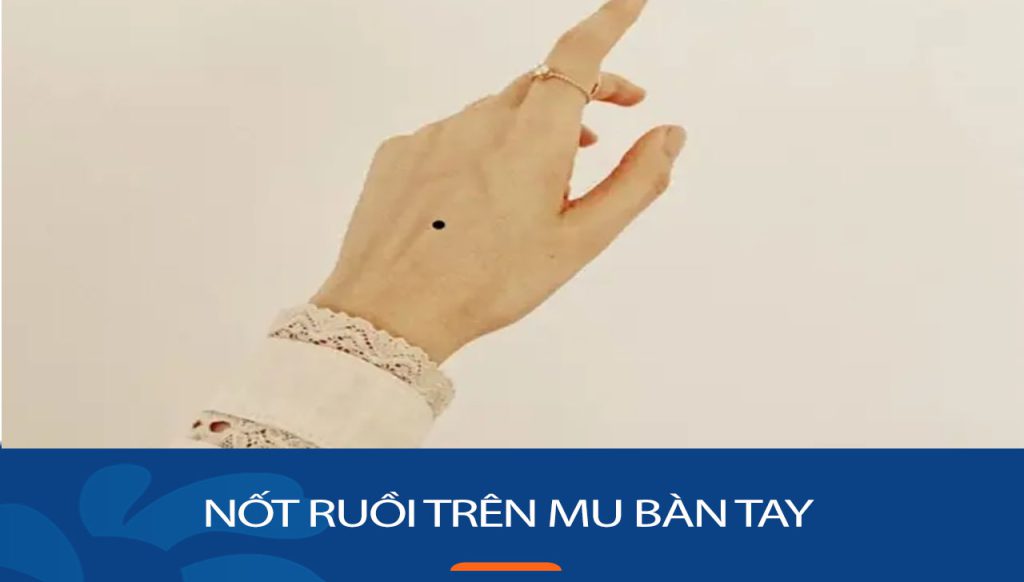 Nốt ruồi trên mu bàn tay: Giải mã bí ẩn Tốt – Xấu cho Nam & Nữ