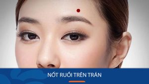 Nốt ruồi trên trán: Giải mã ý nghĩa & vận mệnh tương lai