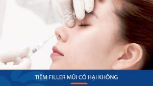 Tiêm filler nâng mũi có hại không? Bác sĩ Kangnam giải đáp