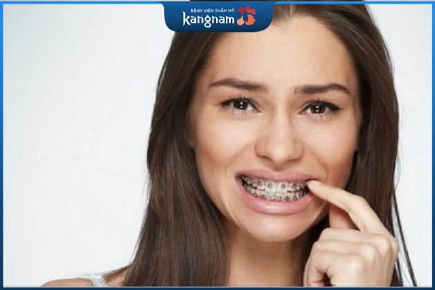 Niềng răng có hạ gò má không cũng tùy thuộc vào yếu tố tuổi tác của mỗi người