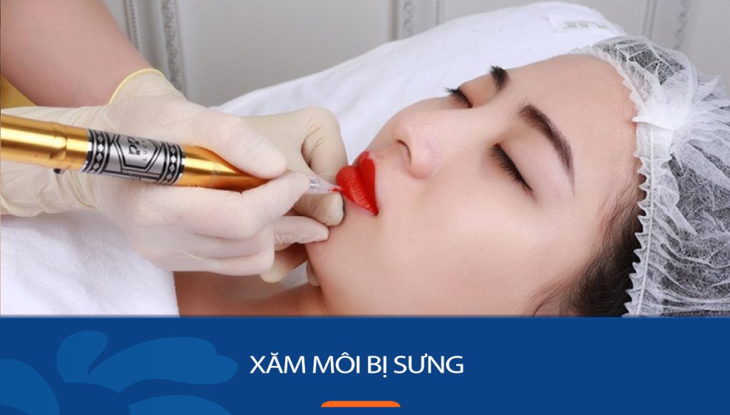 Hướng dẫn cách xử lý khi xăm môi bị sưng