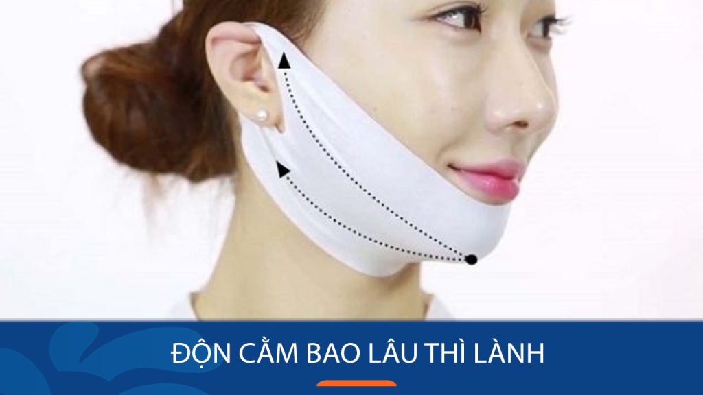 Độn cằm bao lâu thì lành? Giải đáp mọi thắc mắc về thời gian hồi phục