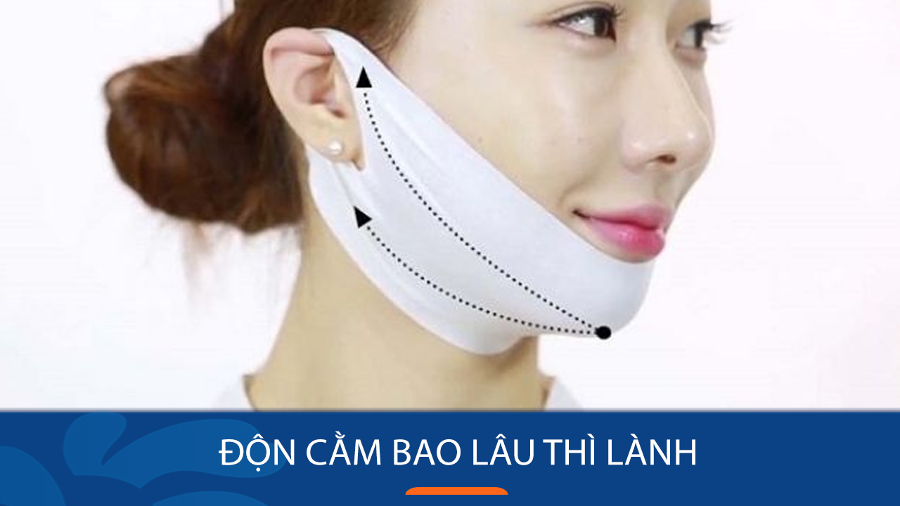 Độn cằm bao lâu thì lành? Giải đáp mọi thắc mắc về thời gian hồi phục