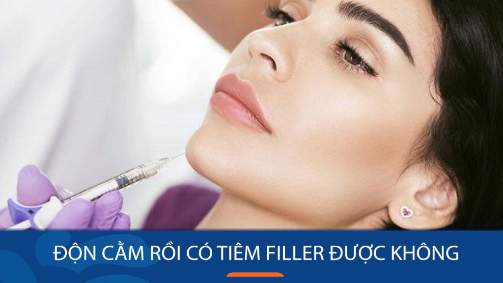 Đã từng độn cằm có nên tiêm filler? Giải đáp thắc mắc từ chuyên gia