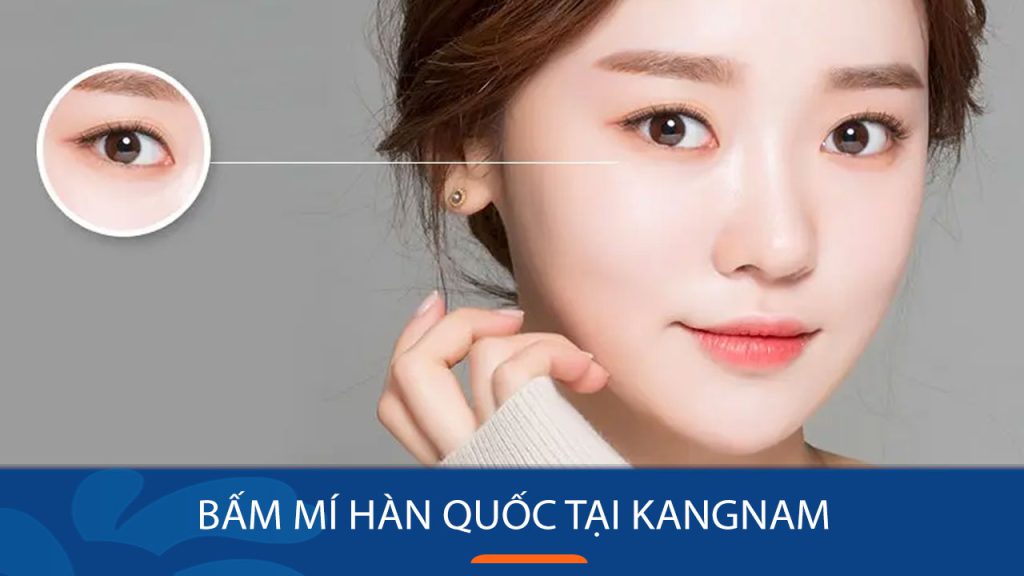 Bấm mí Hàn Quốc: Bí quyết sở hữu đôi mắt to tròn, long lanh