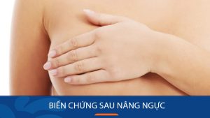 Những biến chứng khi nâng ngực có thể gặp: Bác sĩ kangnam chia sẻ