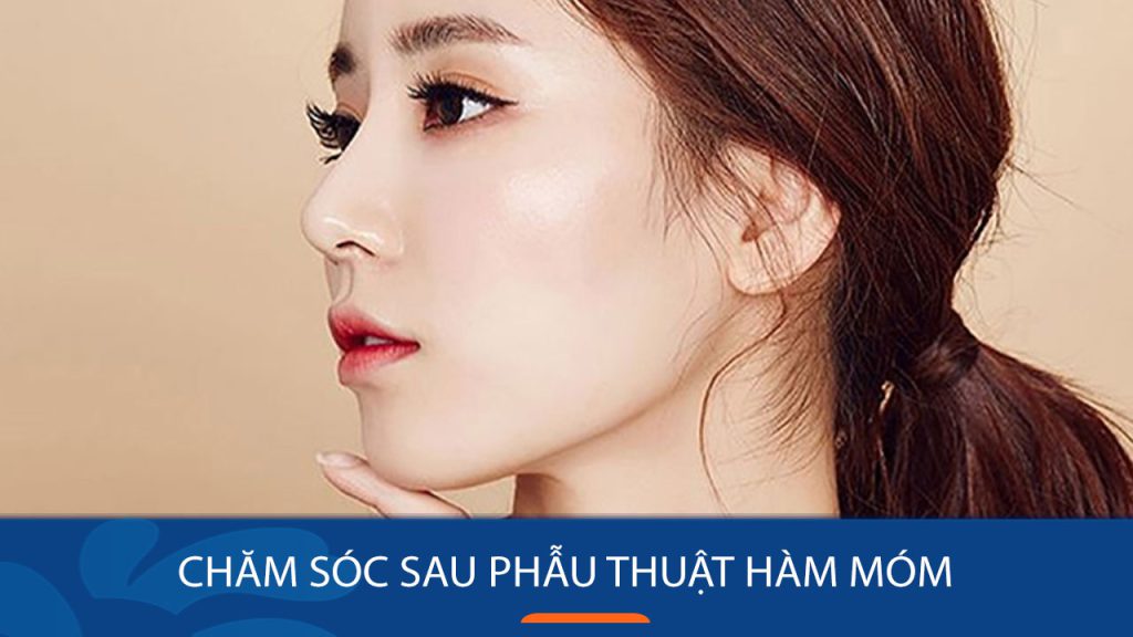Chăm sóc sau phẫu thuật hàm móm: Hướng dẫn nhanh chóng và hiệu quả