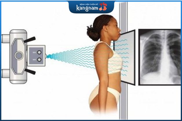 Chụp X quang lồng ngực sẽ được tiến hành trong phòng chuyên biệt,