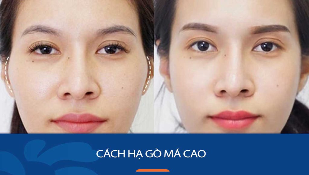 6 Bí quyết hạ gò má thon gọn, tự nhiên chỉ trong 7 ngày